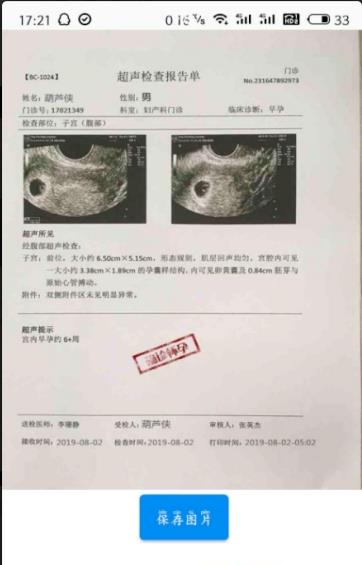 怀孕恶搞b超生成器照片图片制作app官方下载图3: